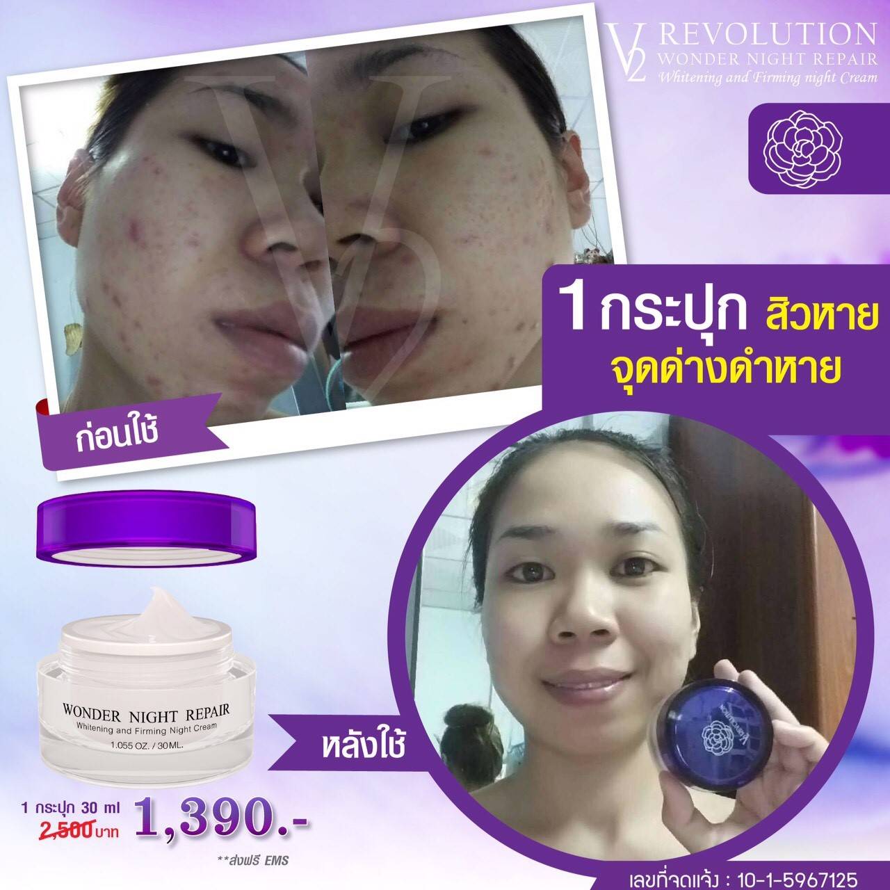 V2 ESTRELLA Premium Gold 30 ML ( ครีมทาหน้าใส ลด กระ ฝ้า จุดด่างดำ ปรับสีผิว ตอนเช้า )